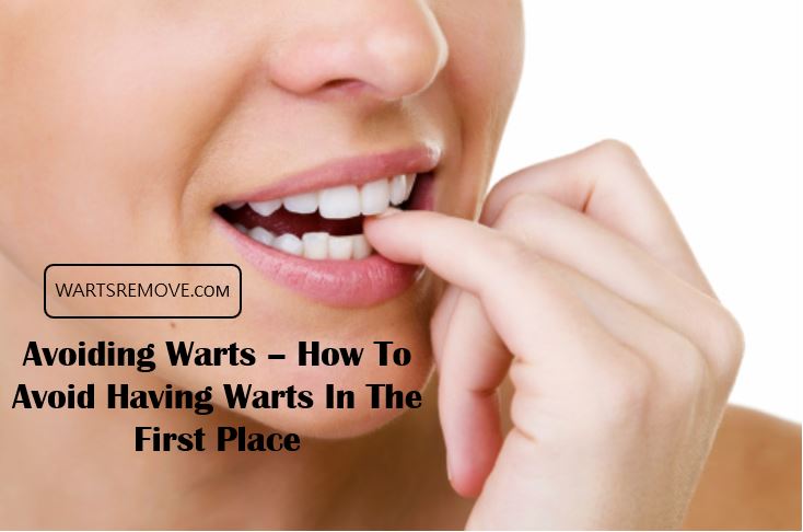 Avoiding Warts – How To Avoid Having Warts In The First Place