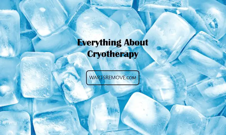 Everything About Cryotherapy