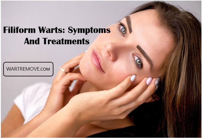 Filiform Warts: Symptoms And Treatments