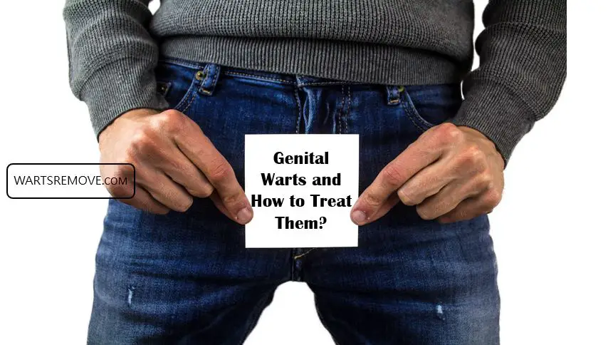 Genital Warts and How to Treat Them?