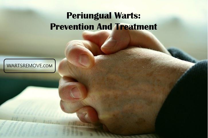 Periungual Warts: Prevention And Treatment