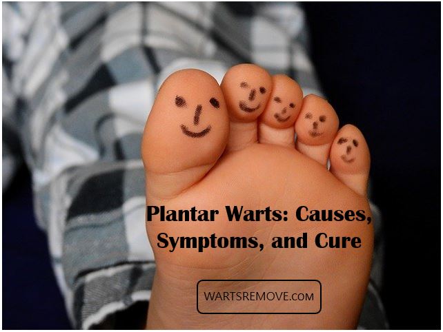 Plantar Warts: Causes, Symptoms, and Cure