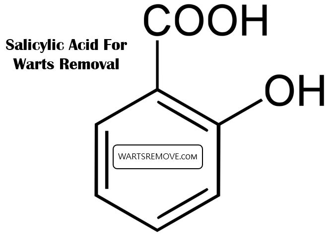Salicylic Acid For Warts Removal