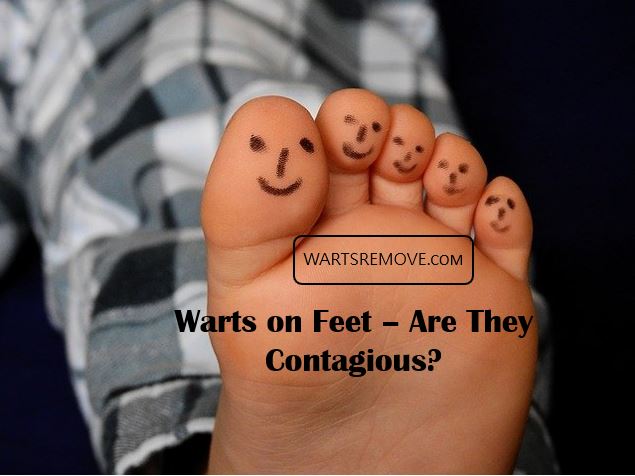 Warts on Feet – Are They Contagious?