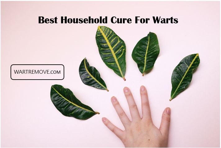 Best Household Cure For Warts