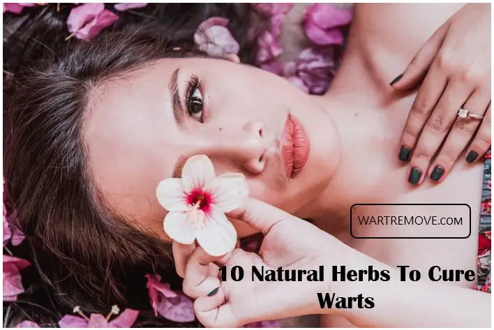 10 Natural Herbs To Cure Warts