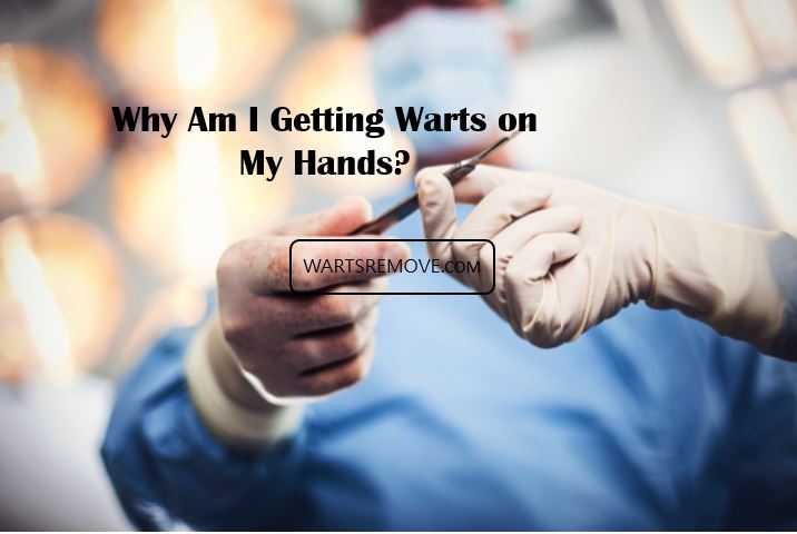 Why Am I Getting Warts on My Hands?